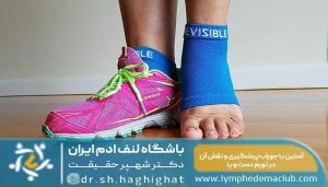 ورم دست و پا