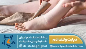 تصویر فرد دیابتی در حال بانداژ پا برای کنترل لنف ادم