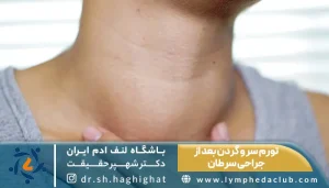 تورم سر و گردن