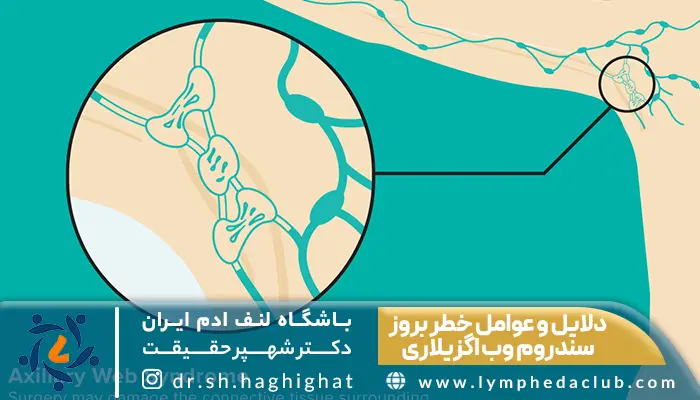 تصویر دلایل و عوامل خطر بروز سندروم وب اگزیلاری