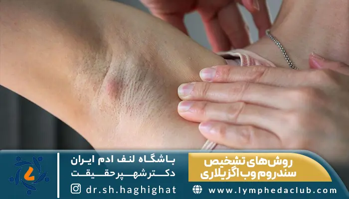 تصویر بیمار درگیر با سندروم وب اگزیلاری