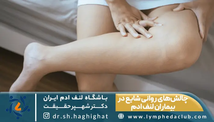 لنف ادم پا و بررسی چالش روانی در بیماران لنف ادم