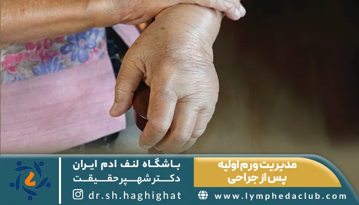 ورم دست لنف ادم و توضیح مدیریت ورم اولیه پس از جراحی
