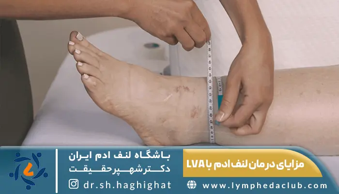 کم شودن حجم ورم پا از مزایا جراحی پیوند غدد لنفاوی