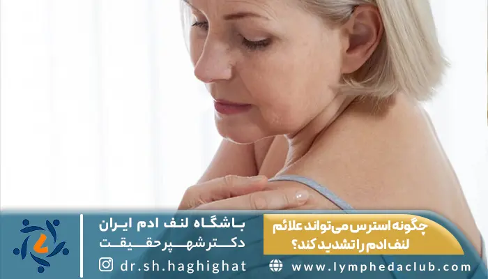 خانم جوانی که استرس روی علائم لنف ادم او تاثیر گذاشته است