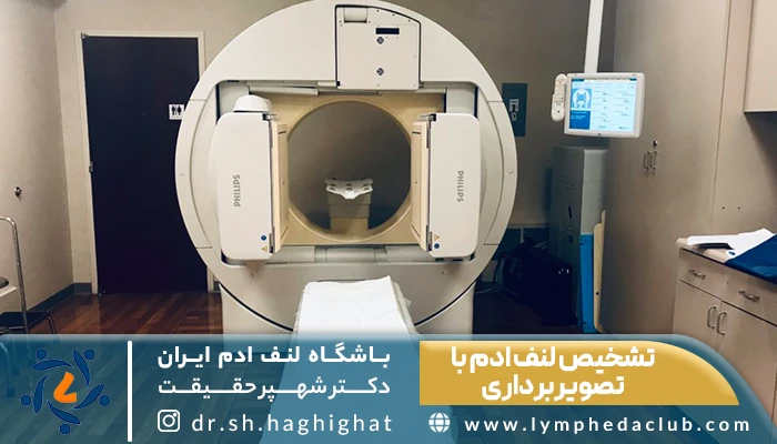 سی تی اسکن و تشخیص لنف ادم با تصویربرداری