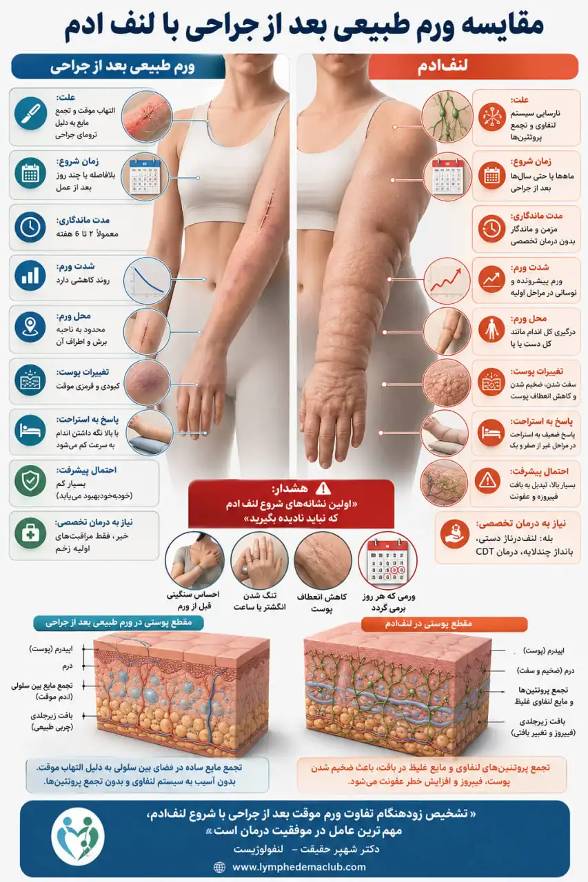 تفاوت ورم طبیعی بعد از جراحی با لنف ادم 