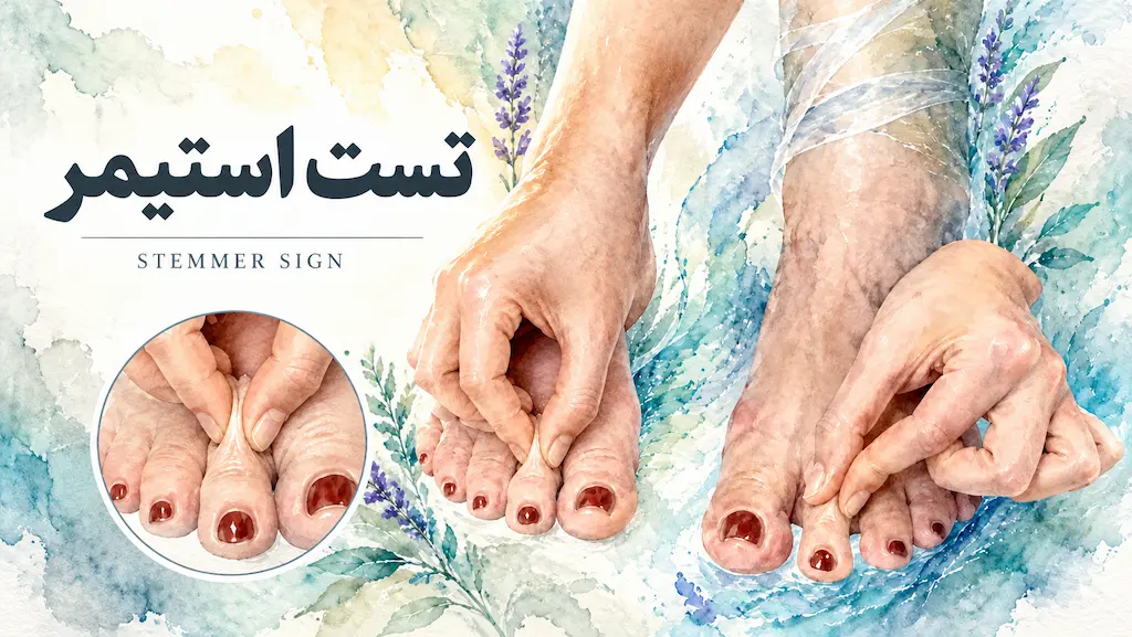 تست استیمر