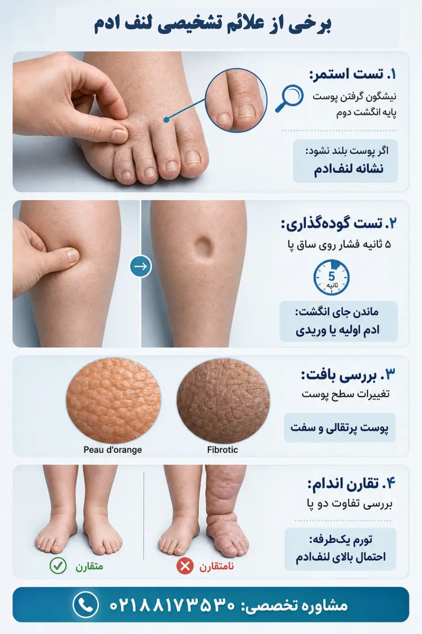 اینفوگرافیک برخی علائم لنف ادم در افراد چاق 
